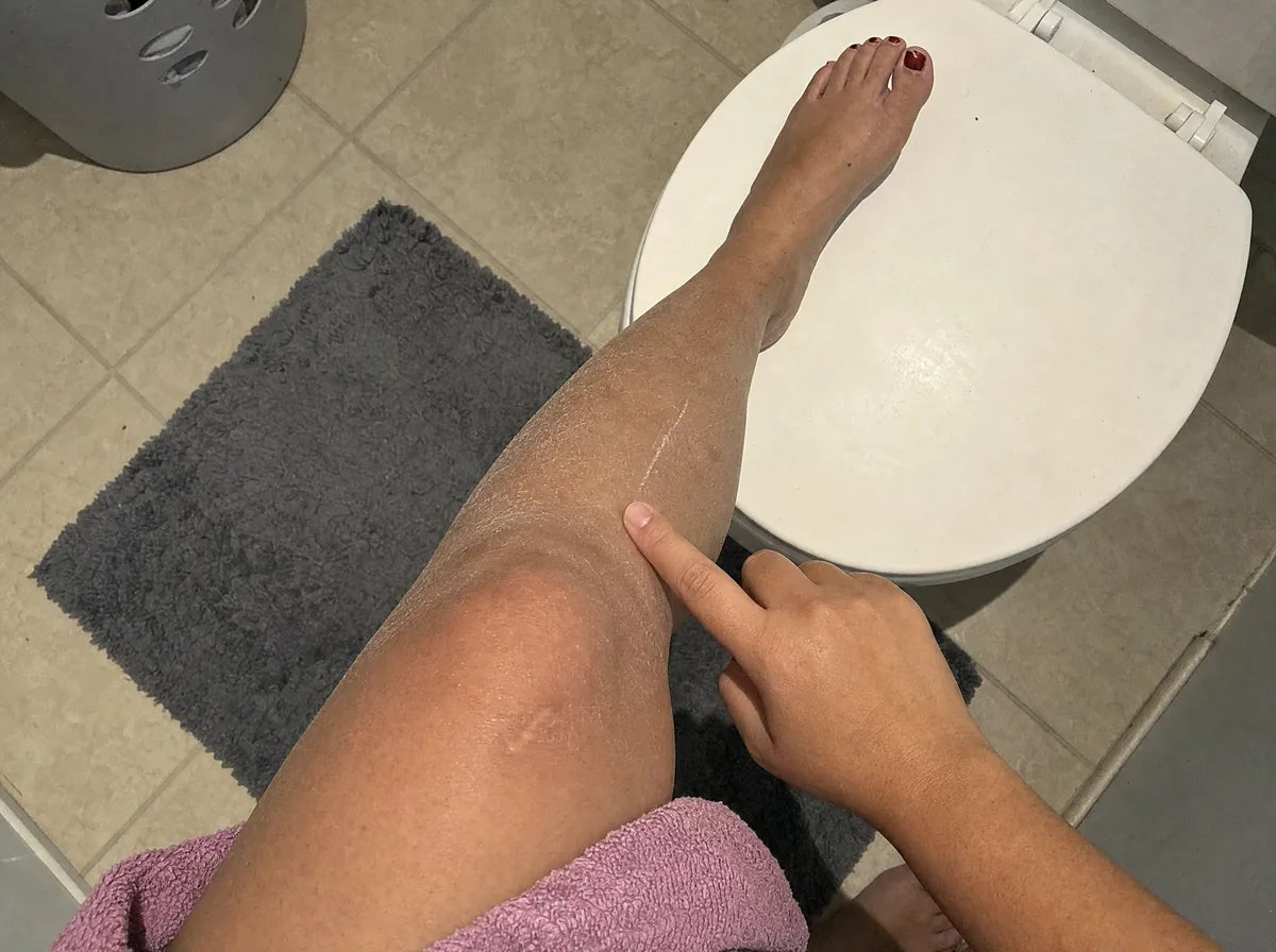 Primer plano de la piel de un antebrazo recién salido del baño.